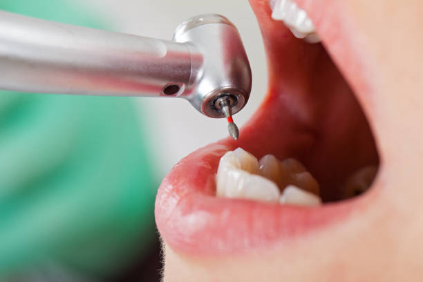 Best Emergency Tooth Extraction in Wayland, MI